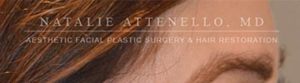 Hair Restoration Case 3999 After Photo Hair Restoration