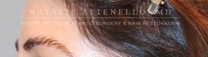 Hair Restoration Case 3999 Before Photo Hair Restoration