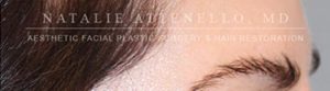 Hair Restoration Case 3999 Before Photo Hair Restoration