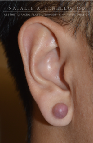 Ears